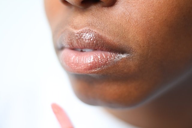 Are Lip Fillers About to Get an Upgrade? Here’s What You Should Know