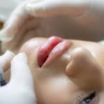 Fillmed Art Filler: A Contemporary Method for Achieving Flawless Skin