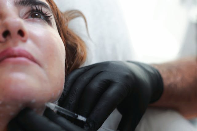 Dermal Fillers: Essential Information on Before and After Effects