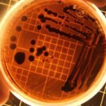 Is It Possible to File a Salmonella Claim Without Legal Help?