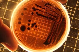 Is It Possible to File a Salmonella Claim Without Legal Help?