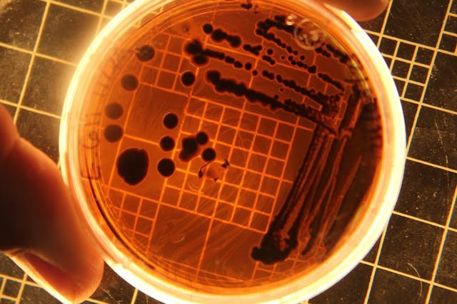 Is It Possible to File a Salmonella Claim Without Legal Help?