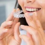 How Straightening Your Teeth Can Change Your Smile