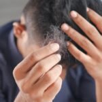 Male Pattern Baldness: Three Treatment Alternatives to Explore