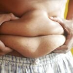 Embrace Your Body: The Benefits of Frozen Belly Fat for Radiance