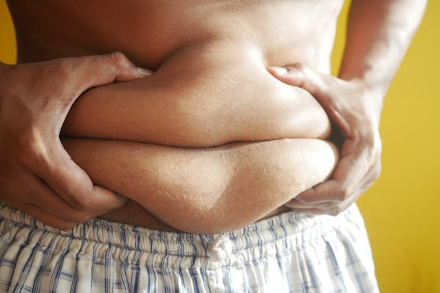 Embrace Your Body: The Benefits of Frozen Belly Fat for Radiance